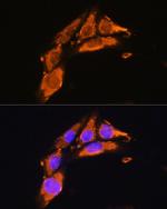 Agrin Antibody in Immunocytochemistry (ICC/IF)