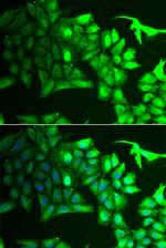 AIPL1 Antibody in Immunocytochemistry (ICC/IF)