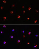 AIPL1 Antibody in Immunocytochemistry (ICC/IF)