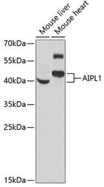 AIPL1 Antibody in Western Blot (WB)