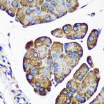 ALG5 Antibody in Immunohistochemistry (Paraffin) (IHC (P))