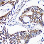 ALG5 Antibody in Immunohistochemistry (Paraffin) (IHC (P))