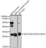 ANT1/ANT2/ANT3/ANT4 Antibody in Western Blot (WB)