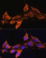 ARF4 Antibody in Immunocytochemistry (ICC/IF)