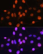 ARX Antibody in Immunocytochemistry (ICC/IF)