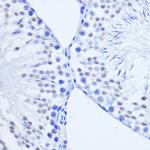 ARX Antibody in Immunohistochemistry (Paraffin) (IHC (P))