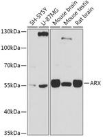 ARX Antibody in Western Blot (WB)