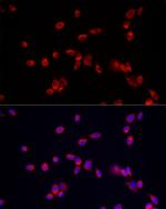 ATP13A2 Antibody in Immunocytochemistry (ICC/IF)