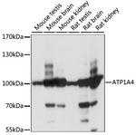 ATP1A4 Antibody in Western Blot (WB)