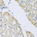 ATP2C1 Antibody in Immunohistochemistry (Paraffin) (IHC (P))