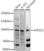 ATP2C1 Antibody in Western Blot (WB)