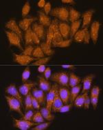 ATP6V1E1 Antibody in Immunocytochemistry (ICC/IF)