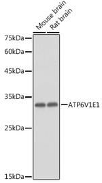 ATP6V1E1 Antibody in Western Blot (WB)