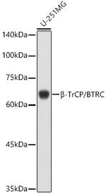 BTRC Antibody in Western Blot (WB)