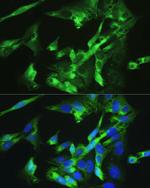 BMPR2 Antibody in Immunocytochemistry (ICC/IF)