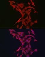 BTRC Antibody in Immunocytochemistry (ICC/IF)