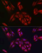 BTRC Antibody in Immunocytochemistry (ICC/IF)