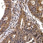 BTRC Antibody in Immunohistochemistry (Paraffin) (IHC (P))