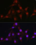 C9orf72 Antibody in Immunocytochemistry (ICC/IF)