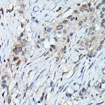 C9orf72 Antibody in Immunohistochemistry (Paraffin) (IHC (P))