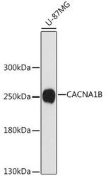 CACNA1B Antibody in Western Blot (WB)