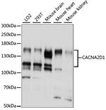 CACNA2D1 Antibody in Western Blot (WB)