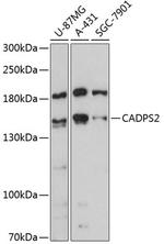 CADPS2 Antibody in Western Blot (WB)