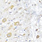 CALHM1 Antibody in Immunohistochemistry (Paraffin) (IHC (P))