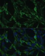 CALU Antibody in Immunocytochemistry (ICC/IF)