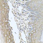 CALU Antibody in Immunohistochemistry (Paraffin) (IHC (P))