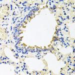 CALU Antibody in Immunohistochemistry (Paraffin) (IHC (P))