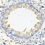 CALU Antibody in Immunohistochemistry (Paraffin) (IHC (P))