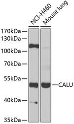 CALU Antibody in Western Blot (WB)