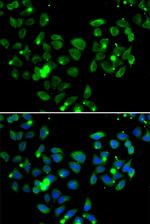 CARD11 Antibody in Immunocytochemistry (ICC/IF)