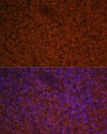 CCL19 Antibody in Immunohistochemistry (Paraffin) (IHC (P))