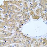 CCM2 Antibody in Immunohistochemistry (Paraffin) (IHC (P))