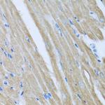 CCM2 Antibody in Immunohistochemistry (Paraffin) (IHC (P))