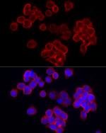 CD70 Antibody in Immunocytochemistry (ICC/IF)