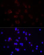 CD70 Antibody in Immunocytochemistry (ICC/IF)