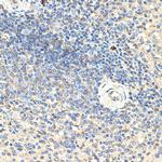 CD70 Antibody in Immunohistochemistry (Paraffin) (IHC (P))