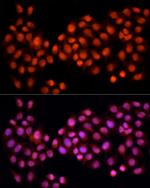 Cdc25A Antibody in Immunocytochemistry (ICC/IF)