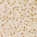 Cdc25A Antibody in Immunohistochemistry (Paraffin) (IHC (P))