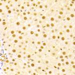 Cdc25A Antibody in Immunohistochemistry (Paraffin) (IHC (P))