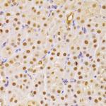 Cdc25A Antibody in Immunohistochemistry (Paraffin) (IHC (P))