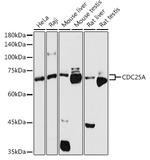 Cdc25A Antibody in Western Blot (WB)