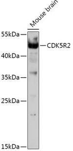 p39 Antibody in Western Blot (WB)