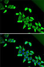 CDKAL1 Antibody in Immunocytochemistry (ICC/IF)