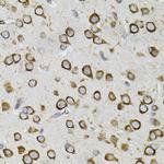 CEP164 Antibody in Immunohistochemistry (Paraffin) (IHC (P))