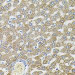 CEP164 Antibody in Immunohistochemistry (Paraffin) (IHC (P))