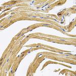 CEP164 Antibody in Immunohistochemistry (Paraffin) (IHC (P))